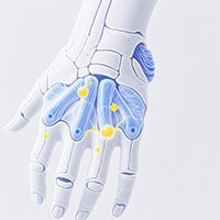 Peripheral Vascular Interventions