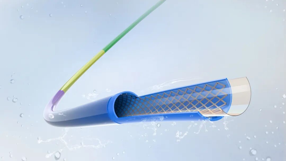 Application of jMedtech PTFE Liner in Neurointerventional Field