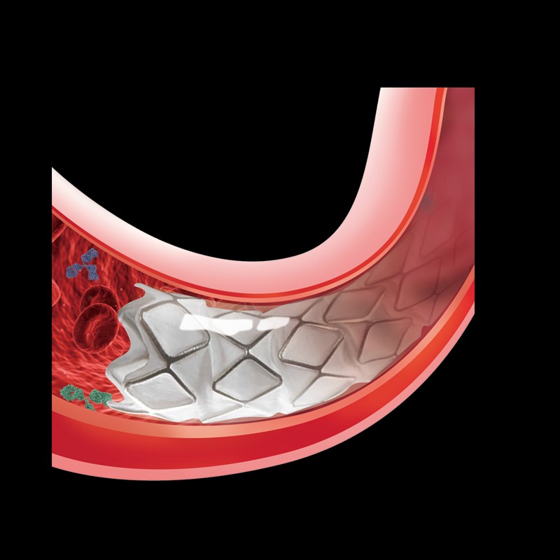 Phosphorylcholine Coating: A Blood-Compatible Solution for Medical Devices